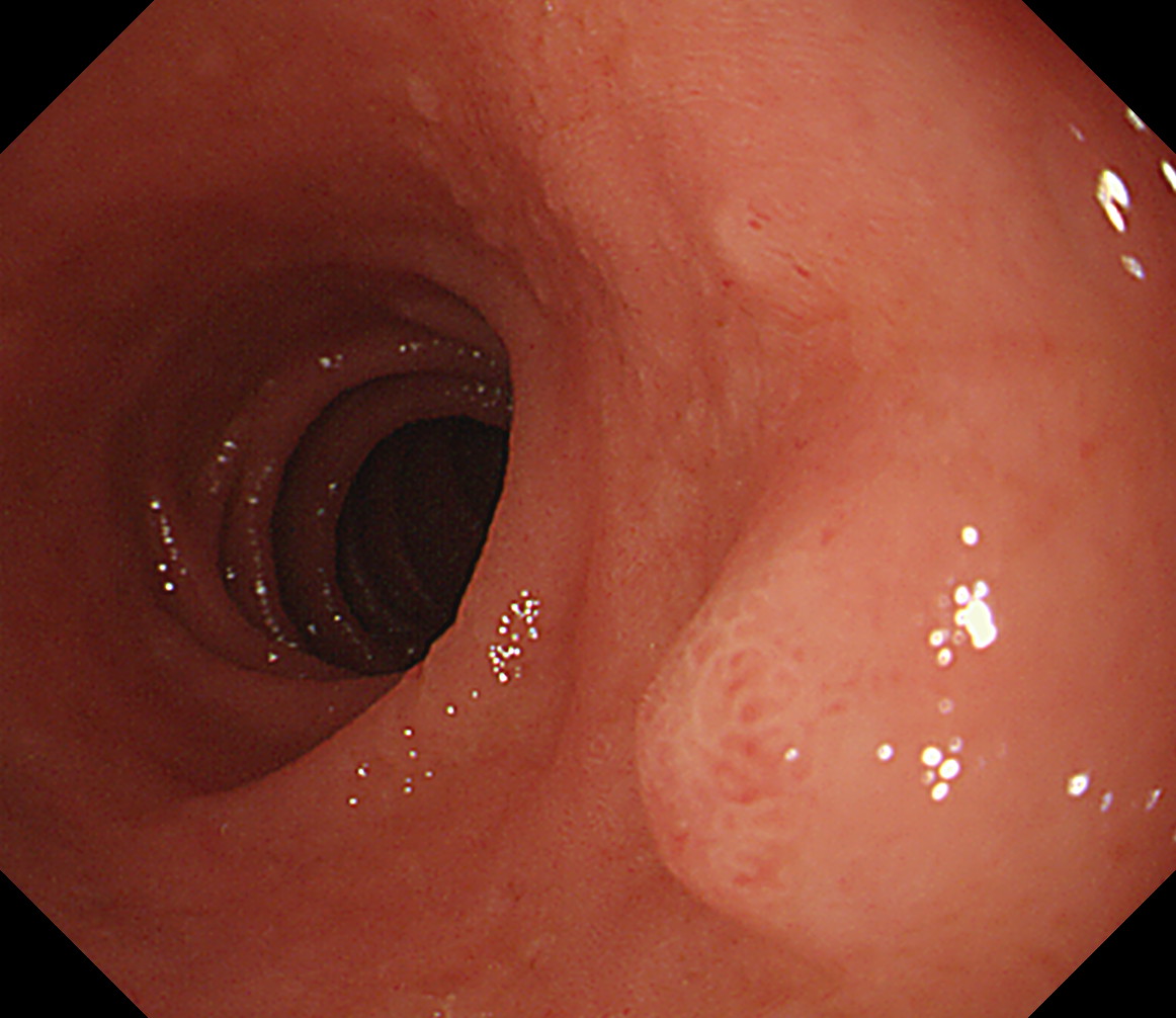 �����H��